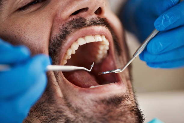 Best Emergency Dental Services for Seniors in Vass, NC
