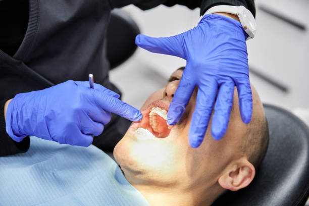 Best Emergency Dentist for Lost Fillings or Crowns in Vass, NC